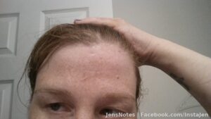 I never even realized I got hit in the face and head. The front of my forehead is scratched and on the right side
