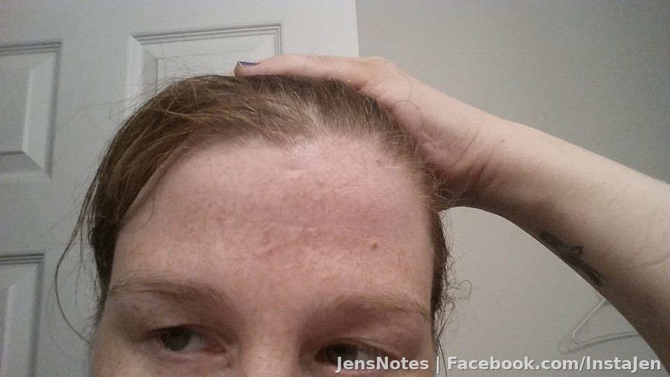 I never even realized I got hit in the face and head. The front of my forehead is scratched and on the right side