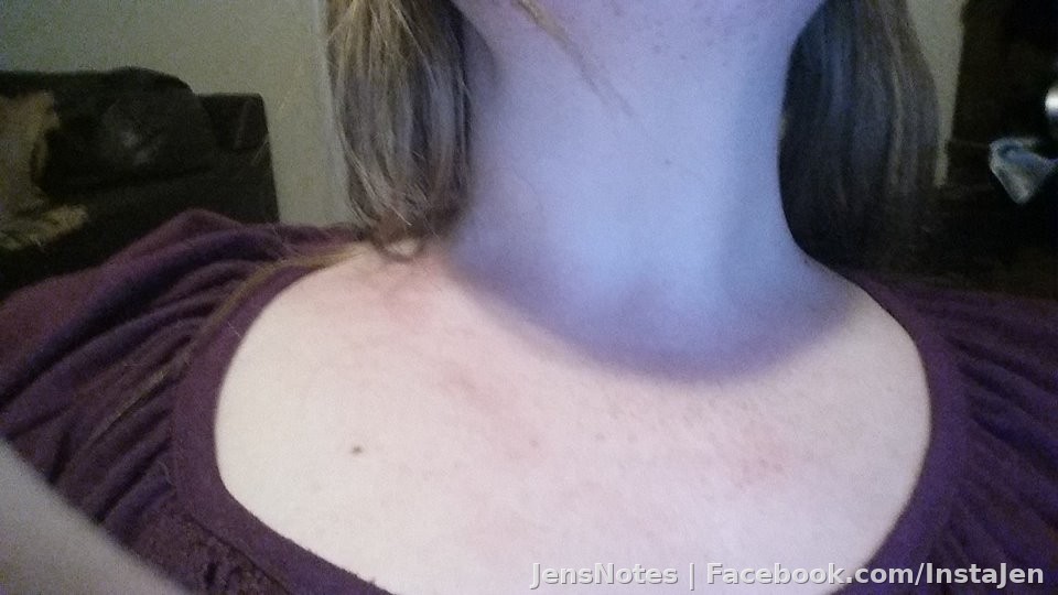 My husband tried to put his hands around my neck