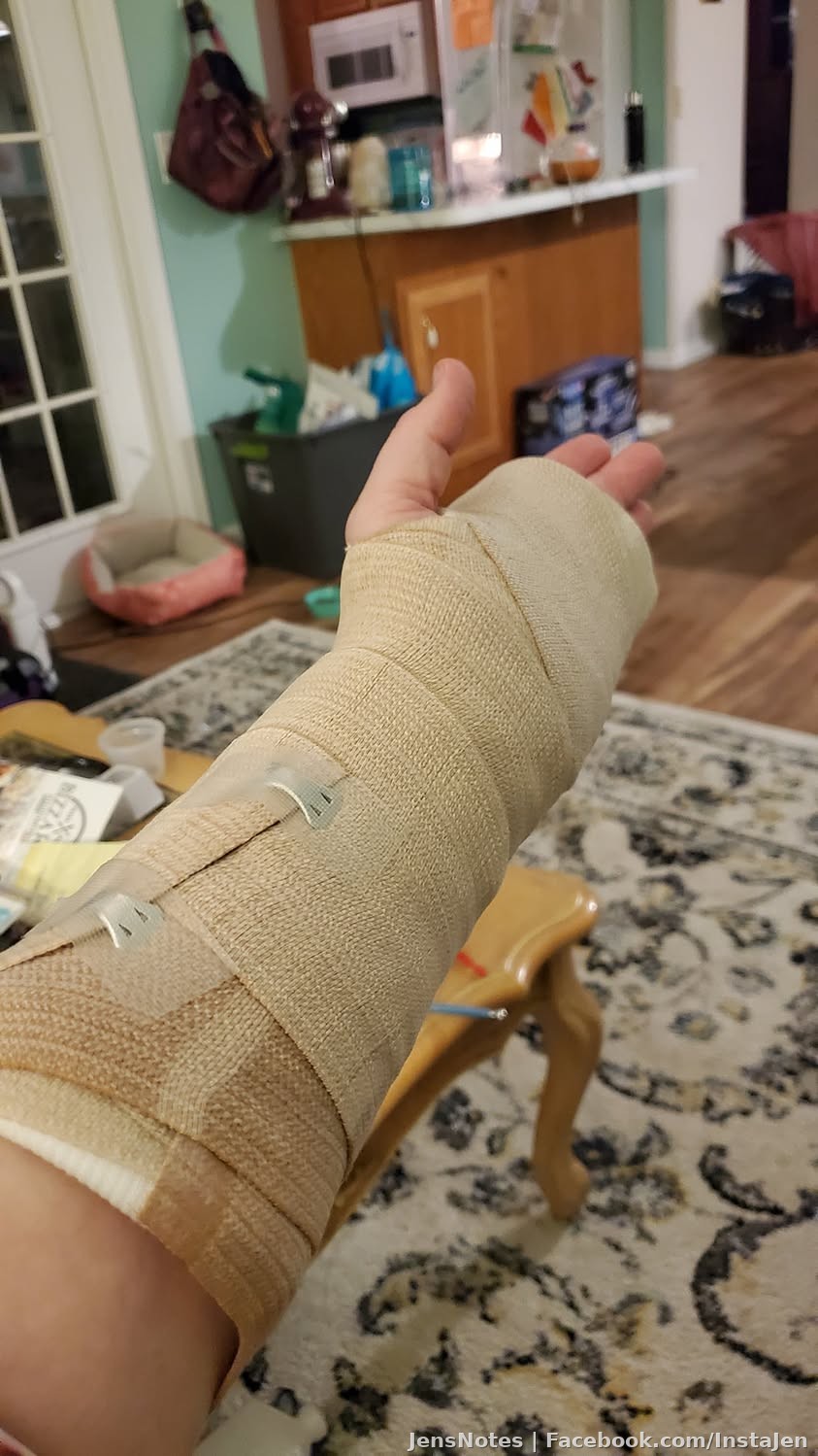 Local family will be happy to know I'm properly splinted by the hospital now. Long story but last Dec I passed out and my