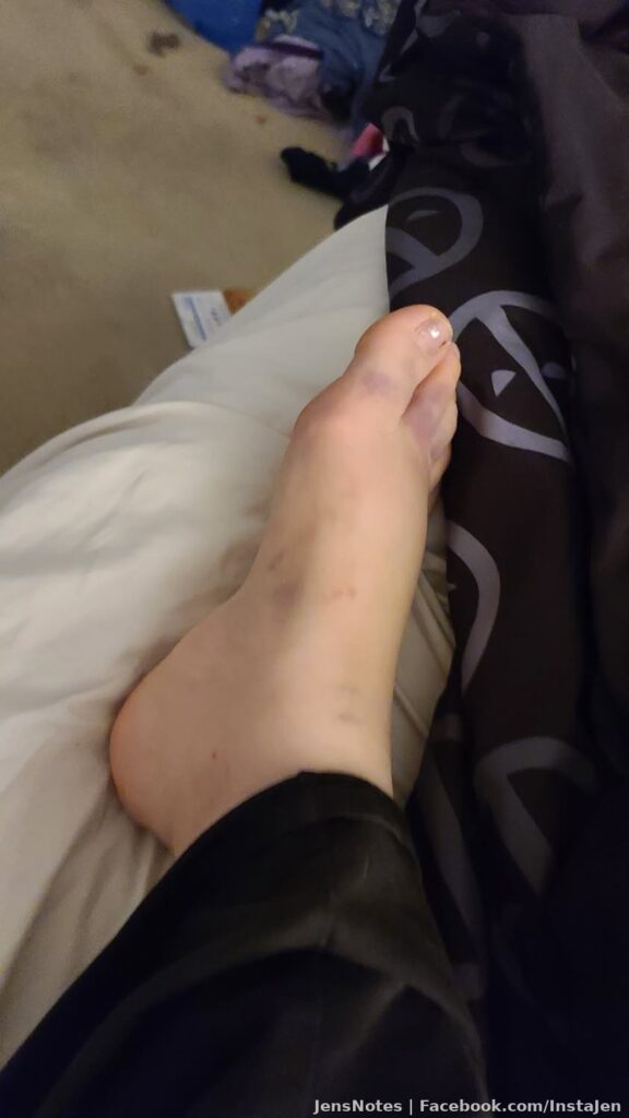 Self loathe in the fact I can't walk today. I'm going after your dad. Broken foot and only a 9yo to help. Thanks Jason,