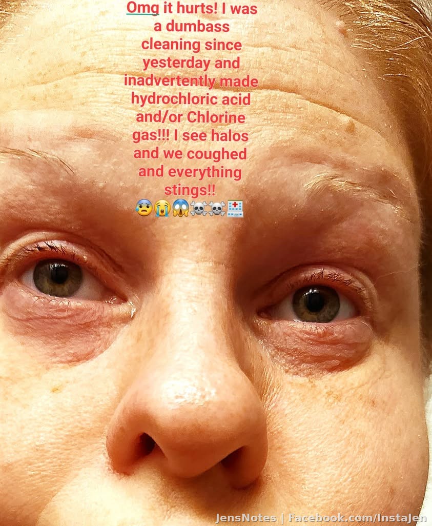 Yeah my eyes are in horrible shape...they look all bloody and crusty. It's been like 5 hours, we've rinsed and repeated and omg. Not
