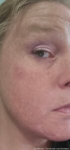 I just got attacked by a mosquito under my eye sitting on my couch indoors. They just will not leave me alone!!!!!!