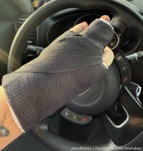 Thanks Amazon for nearly decapitating my fingers because your such a safe facility. That’s called the Amazon F.U.