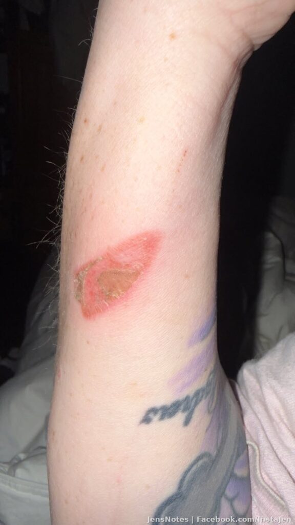 They call me Silvermember. Lol. So I had an unfortunate smelting accident a) involving melting down silver and b) unintentionally causing iron pyrite to