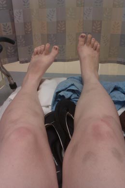 legs_new