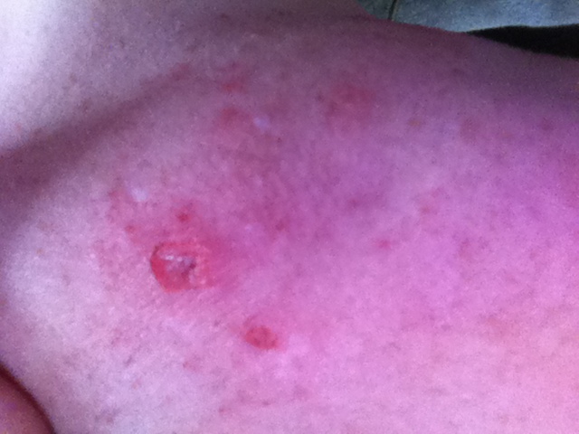 photo2