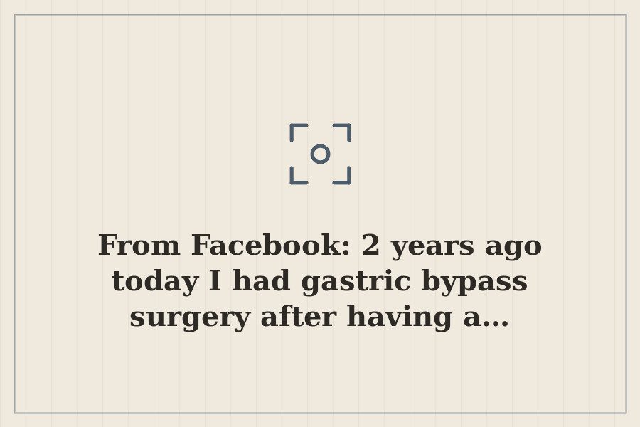 From Facebook: 2 years ago today I had gastric bypass surgery after having a… — cover