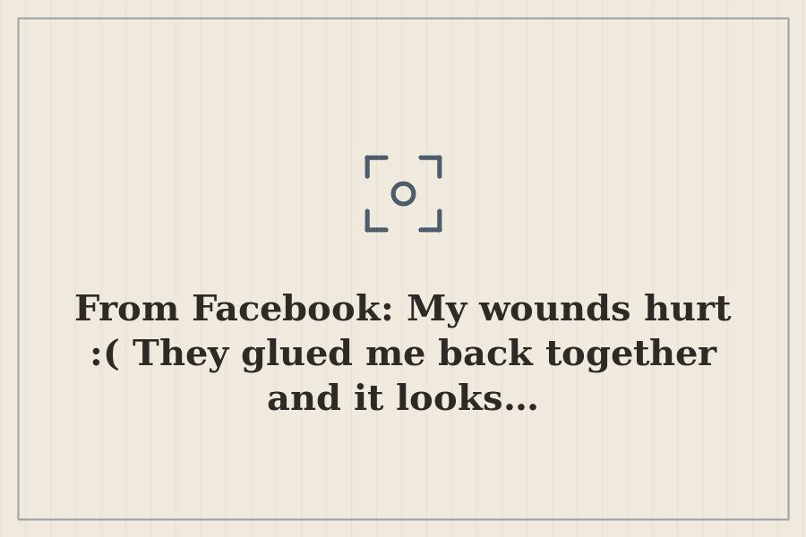From Facebook: My wounds hurt :( They glued me back together and it looks… — cover
